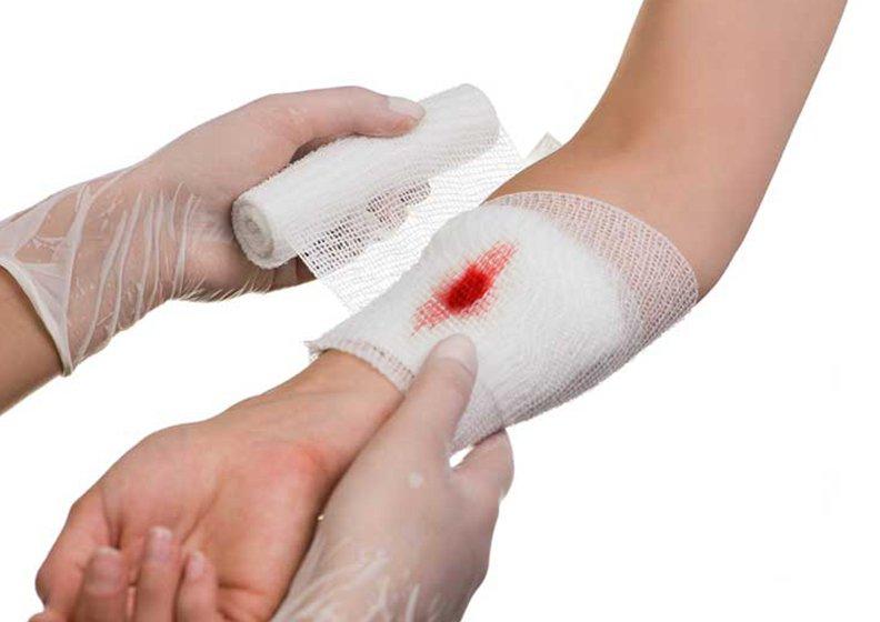 Hướng dẫn sơ cứu vết thương chảy máu bằng cách đè ép và băng vết thương | Vinmec